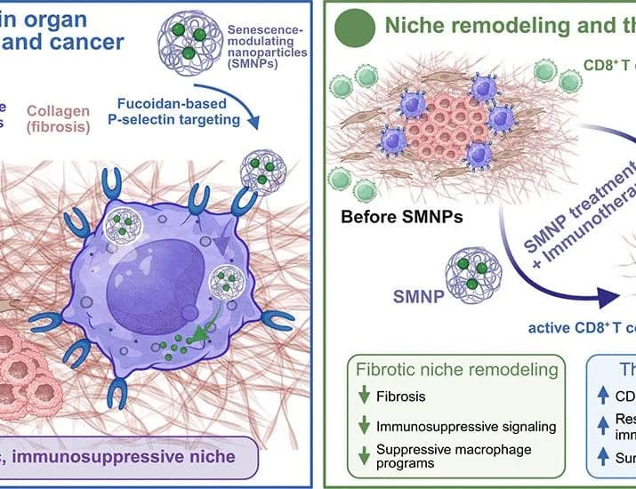 Senescence-directed nanotherapy ameliorates fibrosis and overcomes immune exclusion in cancer | Science
