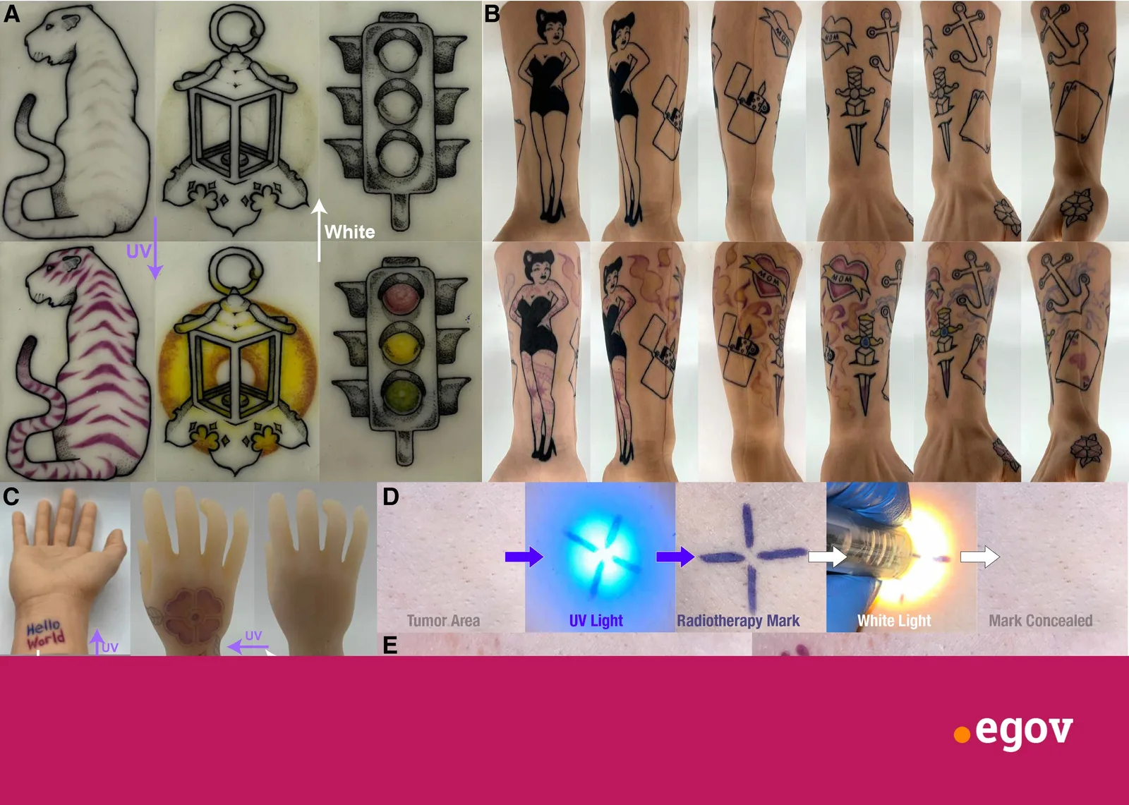 This tattoo ink changes colour with light and can make designs nearly vanish