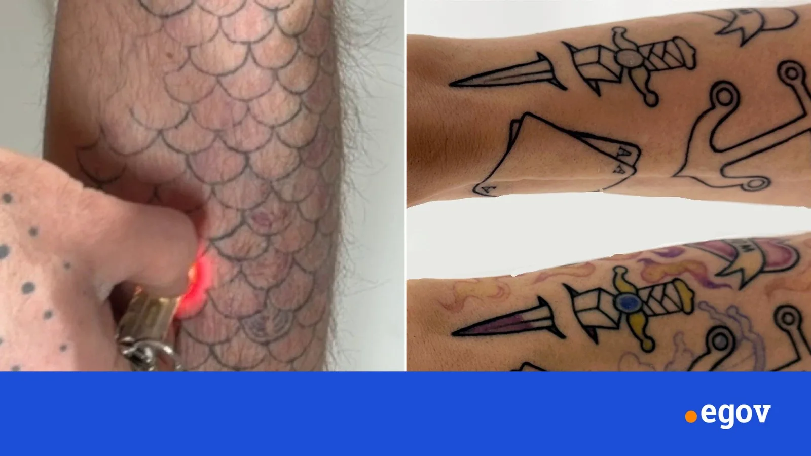PhotoTat: Switchable tattoo inks turn on under UV light and fade with LED exposure