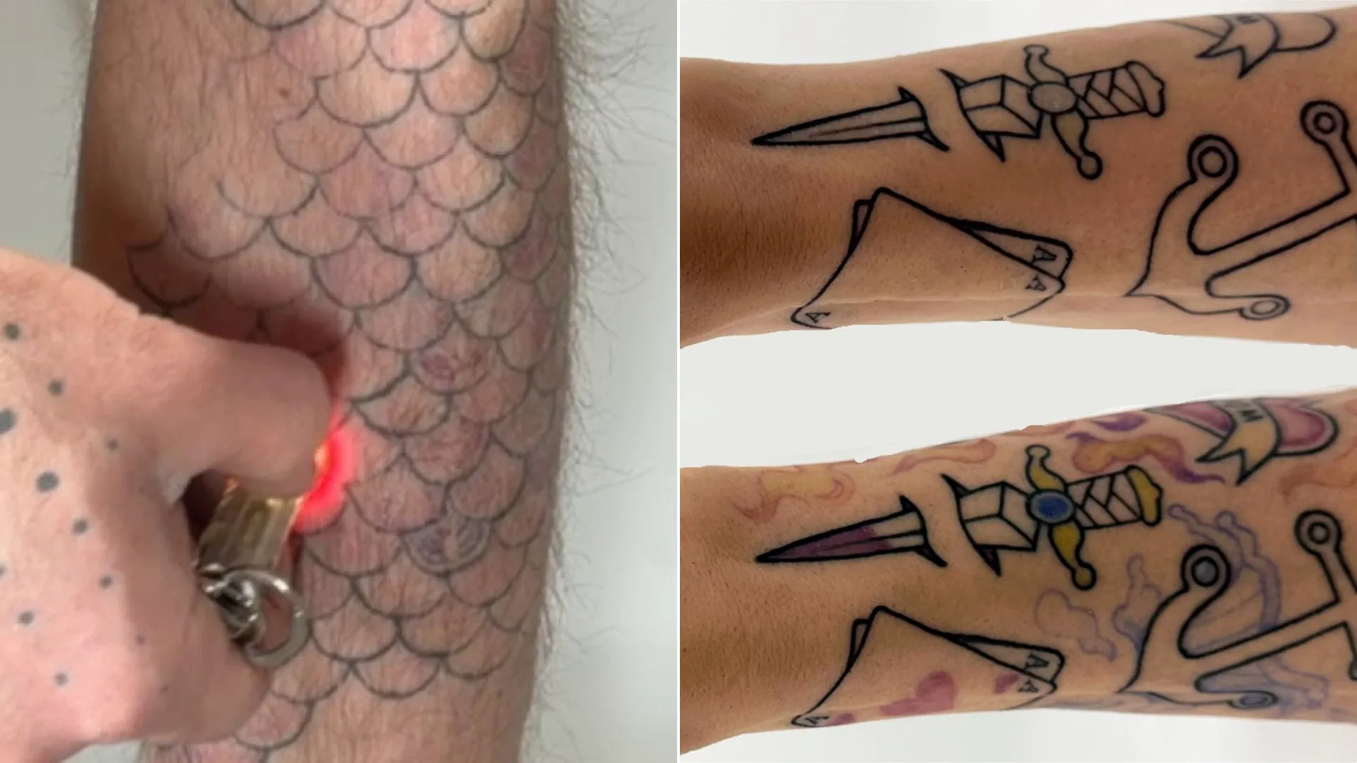 PhotoTat: Switchable tattoo ink lets you hide your body art at work, no laser needed