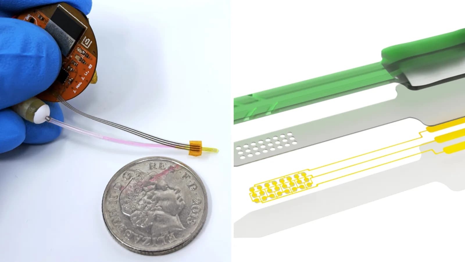 LUCID: An implant as thin as cardstock uses ultrasound to push brain tumor drugs farther